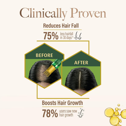 Kesh King Ayurvedic Hair Oil 300ml | Hair Growth & Hairfall Reduction