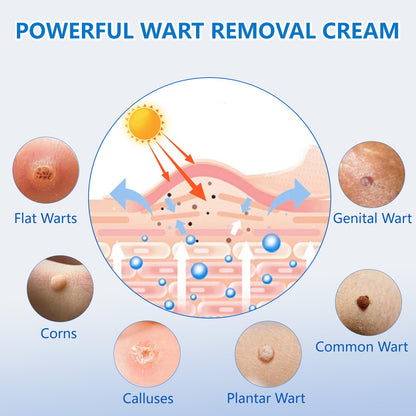 KIbabyDI Wart Remover Gel – Fast Acting Freeze Treatment for Genital, Plantar, Common, Corn & Flat Warts (1 Pack, Red 10101)