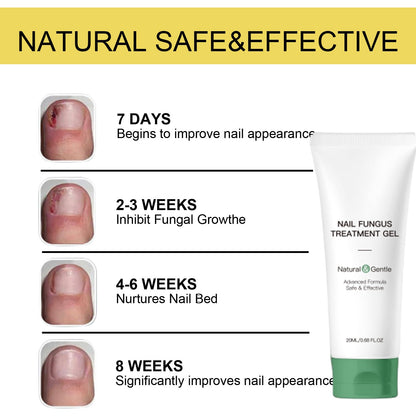 KUNLEN Nail Fungus Gel & Cream – 2pc Nail Repair Oil Serum