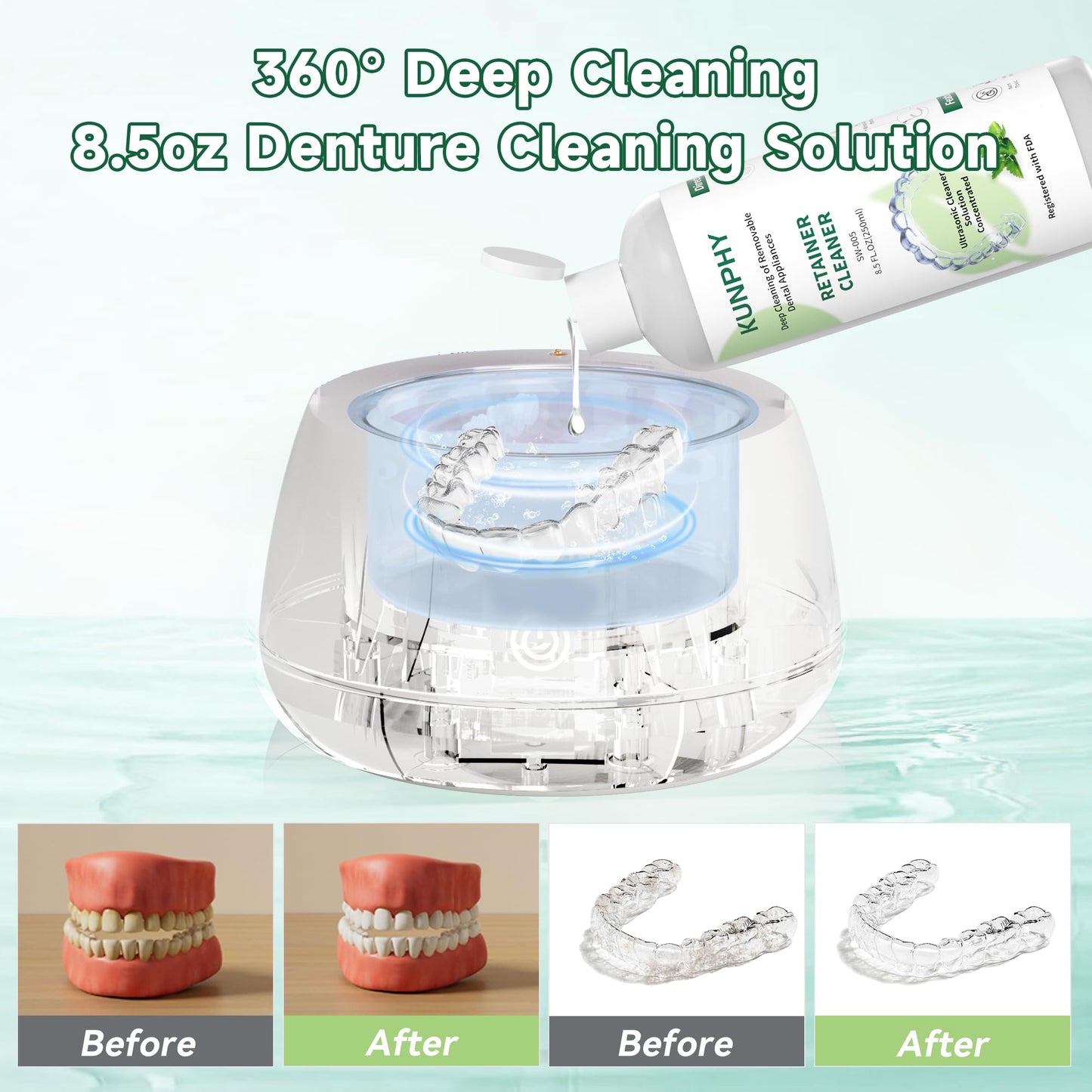 KUNPHY Ultrasonic Retainer Cleaner 8oz Mint – Professional Cleaning for Retainers, Dentures & Aligners