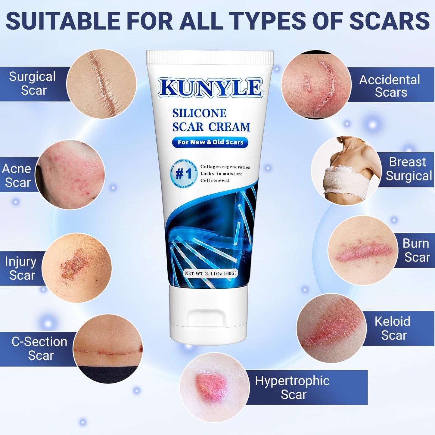 Kunyle Scar Cream – Silicone Scar Gel for Surgical Scars, Stretch Marks & Keloids (2.11 oz / 60 g)