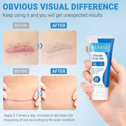 Kunyle Silicone Scar Gel – Advanced Scar Care for Surgical Scars, Keloids, and Stretch Marks | 2.11oz (60g)