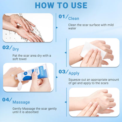 Kunyle Silicone Scar Gel – Advanced Scar Care for Surgical Scars, Keloids, and Stretch Marks | 2.11oz (60g)