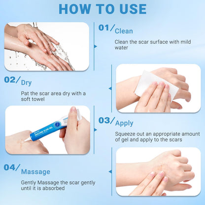 Kunyle Silicone Scar Gel – Advanced Scar Cream for Surgical Scars, Stretch Marks & Keloids | 0.70oz (20g)