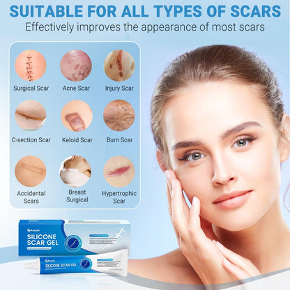 Kunyle Silicone Scar Gel – Advanced Scar Cream for Surgical Scars, Stretch Marks & Keloids | 0.70oz (20g)