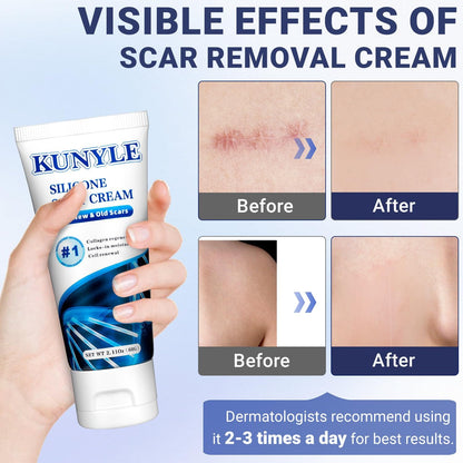 Kunyle Scar Cream – Silicone Scar Gel for Surgical Scars, Stretch Marks & Keloids (2.11 oz / 60 g)