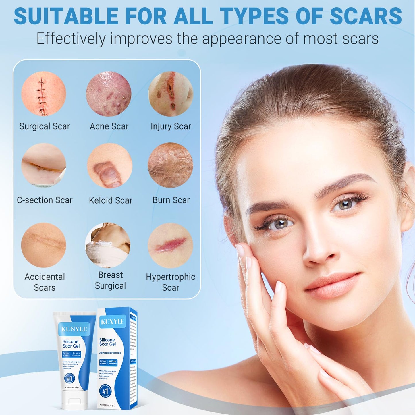Kunyle Silicone Scar Gel – Advanced Scar Care for Surgical Scars, Keloids, and Stretch Marks | 2.11oz (60g)