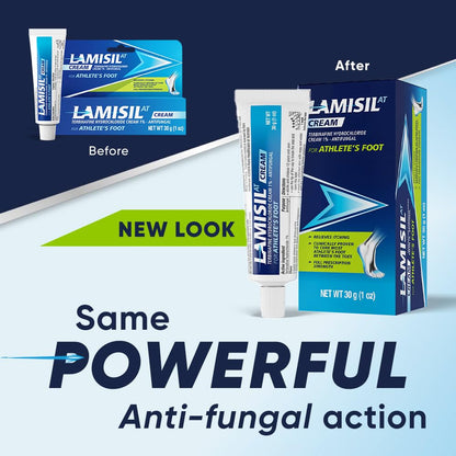 Lamisil 1 Week Athlete’s Foot Treatment – 2-Pack, Terbinafine 1% Cream (1 oz each)