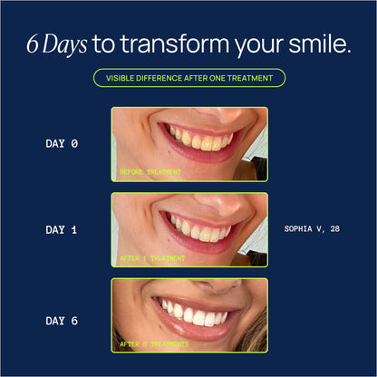 Laughland Gentle Teeth Whitening Gel 3 Pack – Sensitive Teeth Friendly, At-Home Whitening (6 Treatments)