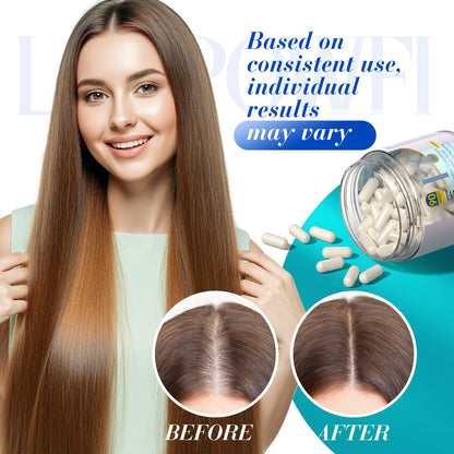 Lazpowfi Hair, Skin & Nails Vitamins – Biotin 10,000mcg + Collagen (90 Capsules)