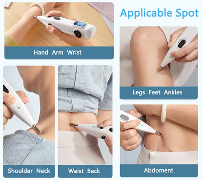 Leawell Electronic Acupuncture Pen – Meridian Acupoints Finder, Electric Acupressure & Pulse Therapy Tool
