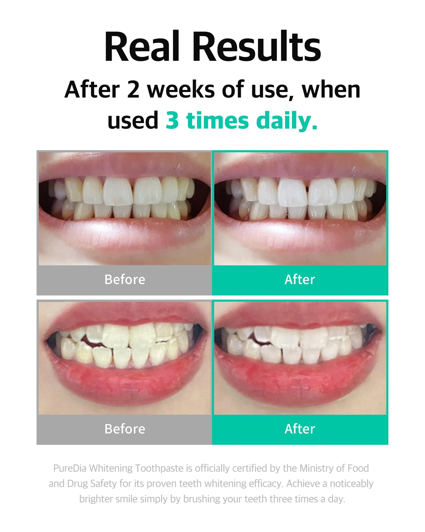 LiveOrals Whitening Toothpaste 3x80g – Fluoride-Free, Nano-Hydroxyapatite