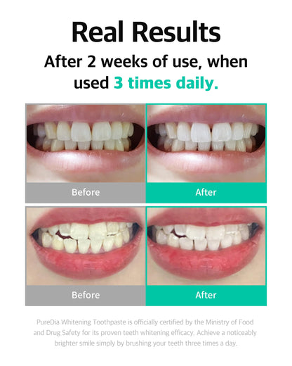 LiveOrals Whitening Toothpaste 3x80g – Fluoride-Free, Nano-Hydroxyapatite