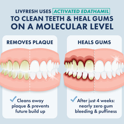 LIVFRESH Toothpaste Gel – Clinically Proven Plaque Removal & Gum Health