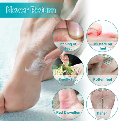 LMNOOP Athletes Foot Treatment Cream | Maximum Strength Fungal Relief