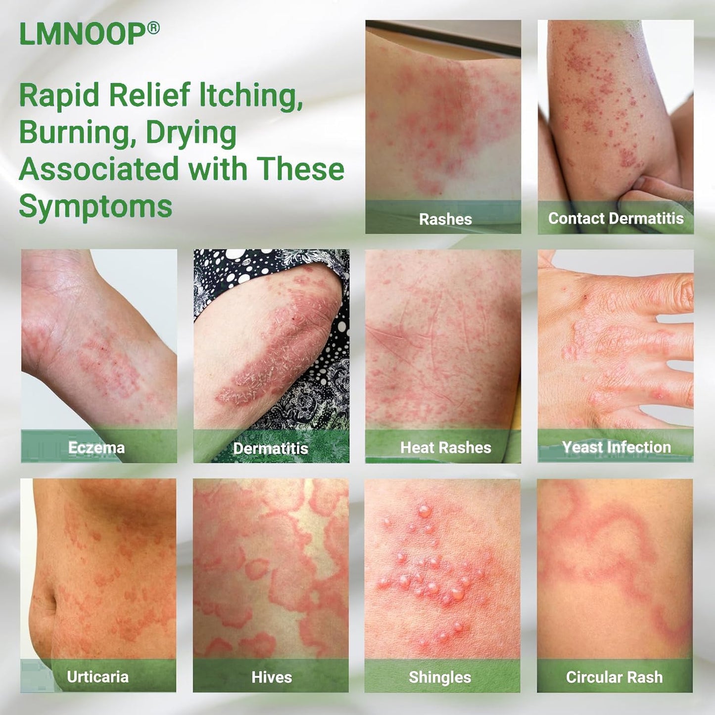 LMNOOP Eczema Cream — Maximum Strength Itch Relief for Dry, Irritated Skin (3.53oz)