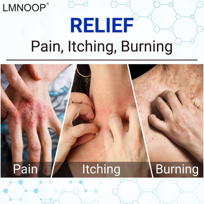 LMNOOP Eczema Cream – Maximum Strength Ointment for Dermatitis, Rash, Psoriasis & More | 2-Pack 1.76oz