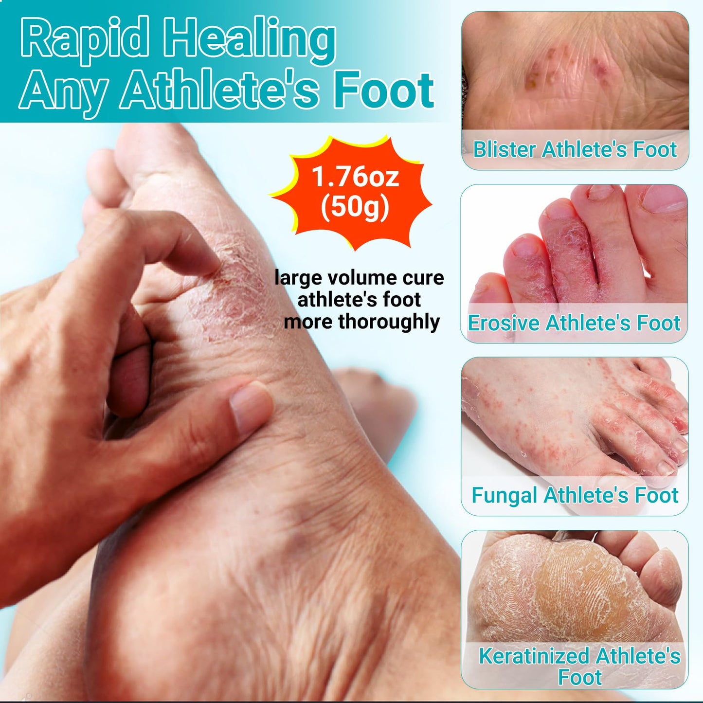 LMNOOP Athletes Foot Treatment Cream | Maximum Strength Fungal Relief