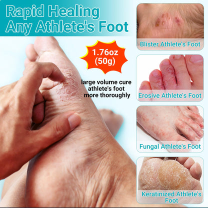 LMNOOP Athletes Foot Treatment Cream | Maximum Strength Fungal Relief