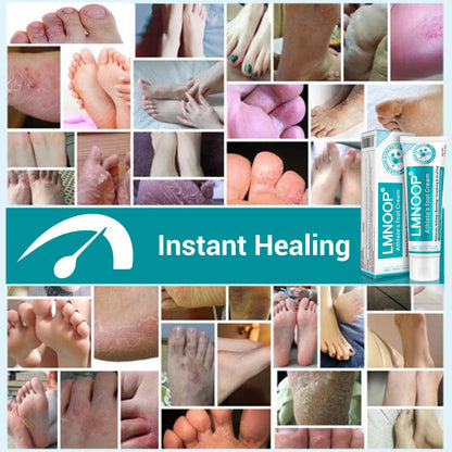 LMNOOP Athletes Foot Treatment Cream | Maximum Strength Fungal Relief