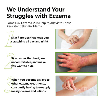 Loma Lux Eczema Pills – Natural Eczema Relief for Adults & Kids | Dermatologist-Developed