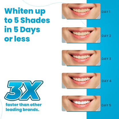 Lumist Teeth Whitening Strips – 10 Strips (5 Treatments), Mint, Sensitive Teeth