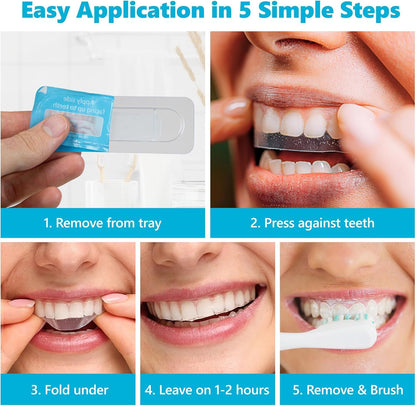 Lumist Teeth Whitening Strips – 10 Strips (5 Treatments), Mint, Sensitive Teeth