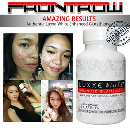 Luxxe White – Glutathione, Vitamin C & Alpha Lipoic Acid for Radiant Skin