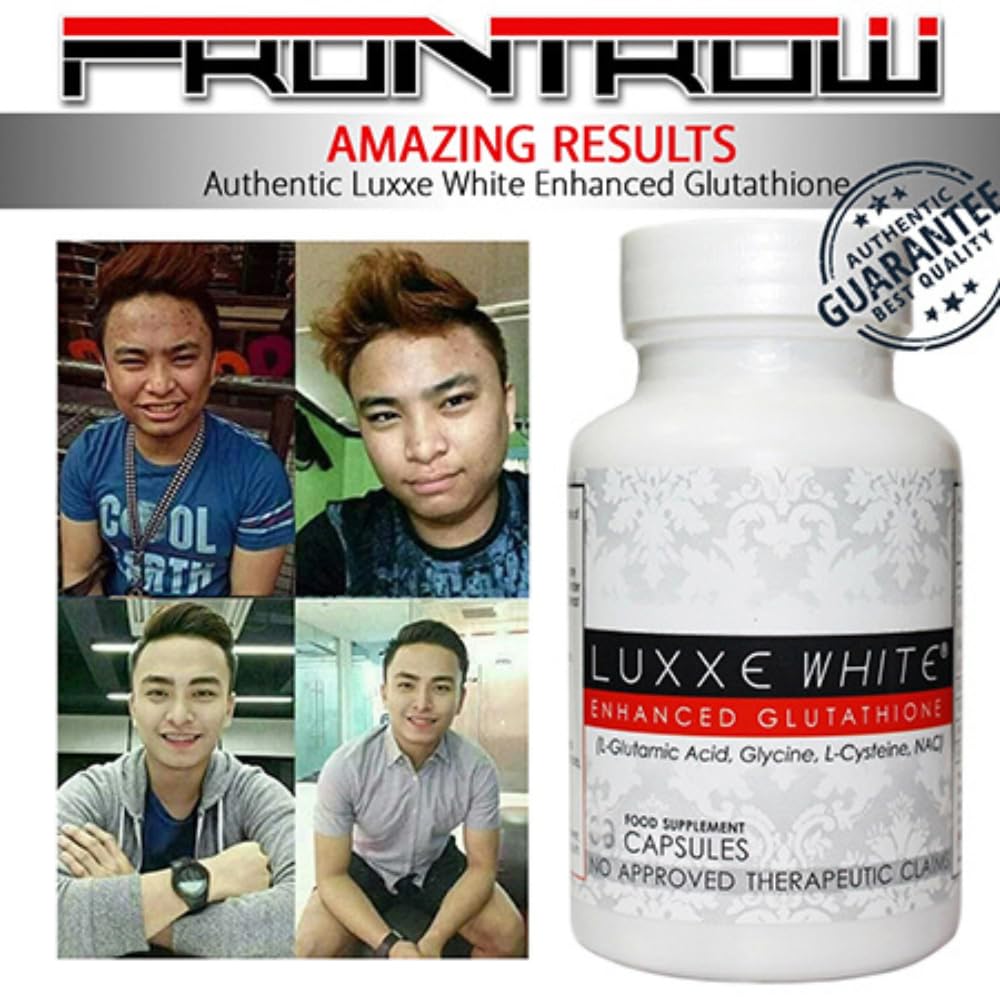 Luxxe White – Glutathione, Vitamin C & Alpha Lipoic Acid for Radiant Skin