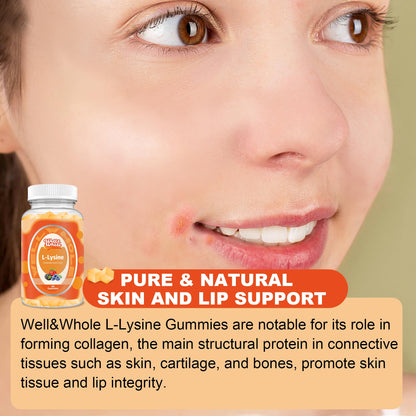 L-Lysine Gummies 1000mg – Lip & Cold Sore Support for Women, 60 Count – Vegan, Non-GMO