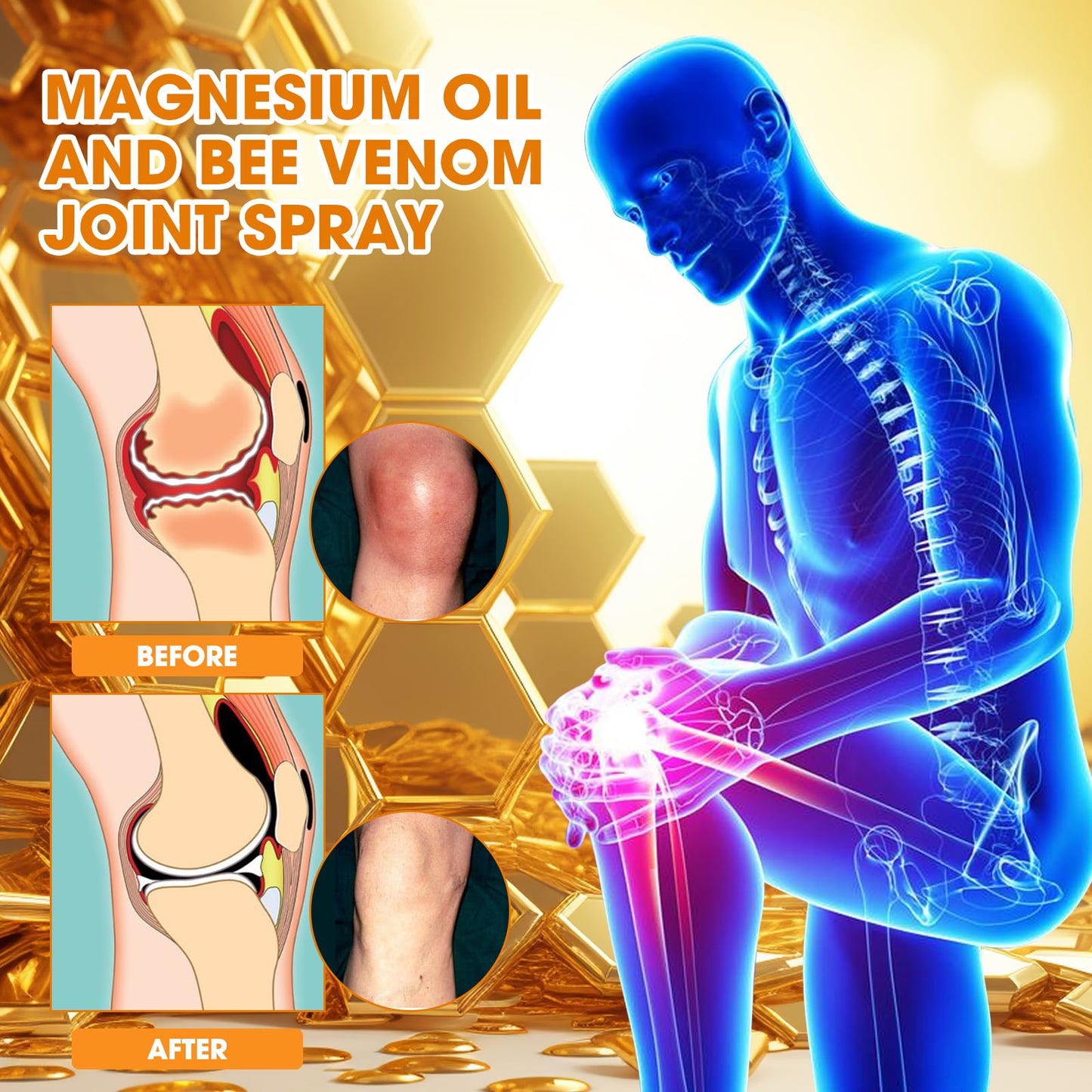 Magnesium Joint Spray | Magnesium Oil & Bee Venom for Joints - 100ml