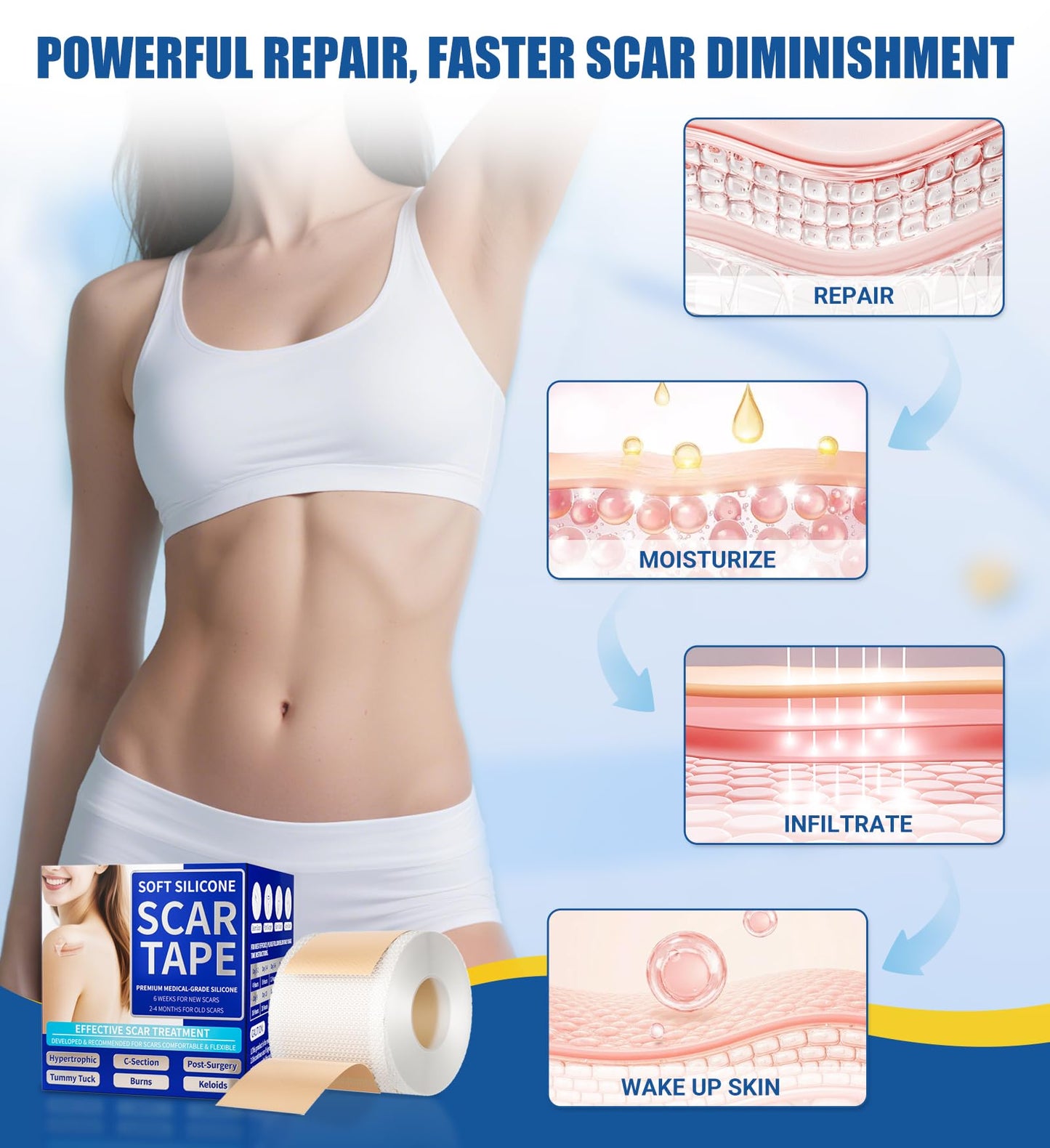 MasterMo Medical Grade Silicone Scar Sheets & Tape – 1.6x60 Roll, Ultra Soft & Hypoallergenic