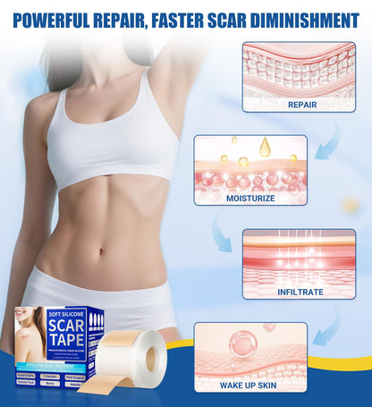 MasterMo Medical Grade Silicone Scar Sheets & Tape – 1.6x60 Roll, Ultra Soft & Hypoallergenic