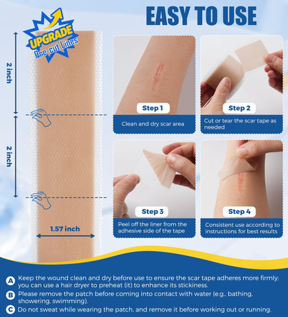 MasterMo Medical Grade Silicone Scar Sheets & Tape – 1.6x60 Roll, Ultra Soft & Hypoallergenic