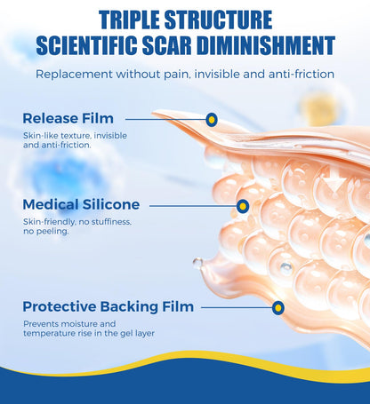 MasterMo Medical Grade Silicone Scar Sheets & Tape – 1.6x60 Roll, Ultra Soft & Hypoallergenic