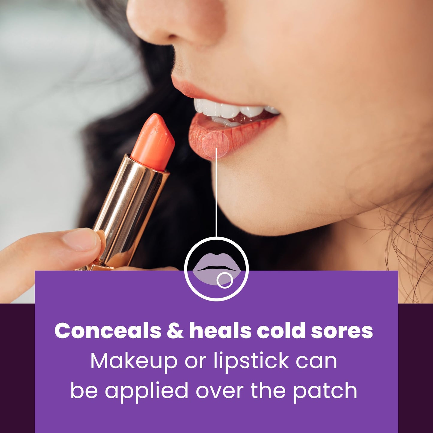 Mederma Cold Sore Discreet Healing Patch | Hydrocolloid Gel for Fast Healing, Pain Relief, Concealment (30 Patches)