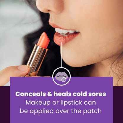 Mederma Cold Sore Discreet Healing Patch | Hydrocolloid Gel for Fast Healing, Pain Relief, Concealment (30 Patches)