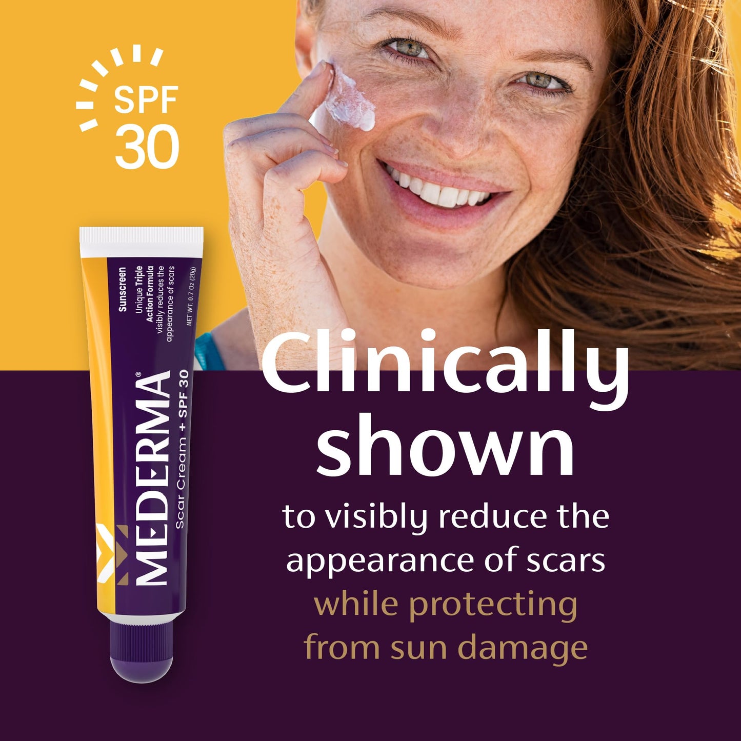 Mederma Scar Cream Plus SPF 30 - Advanced Scar Treatment with Sun Protection (0.7 oz)