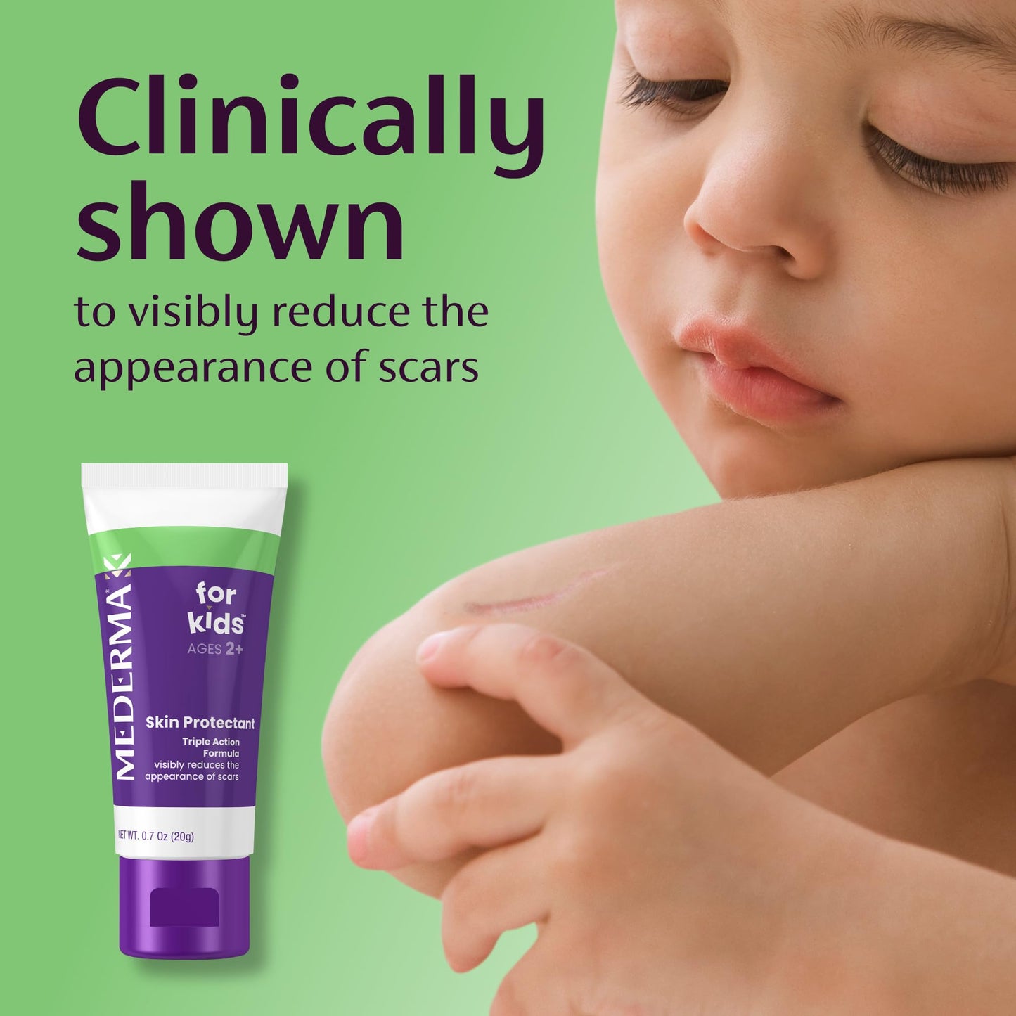 Mederma Scar Gel for Kids — Purple-to-Clear, Grape Scent, 0.70 oz (Ages 2+)