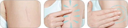 Mederma Skin Care for Scars — Safe, Doctor-Recommended Scar Treatment