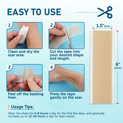 MEDLOT Silicone Scar Sheets – 10pcs Reusable Scar Treatment Strips for Surgical, C-Section, Acne Scars | Breathable & Cut-to-Size