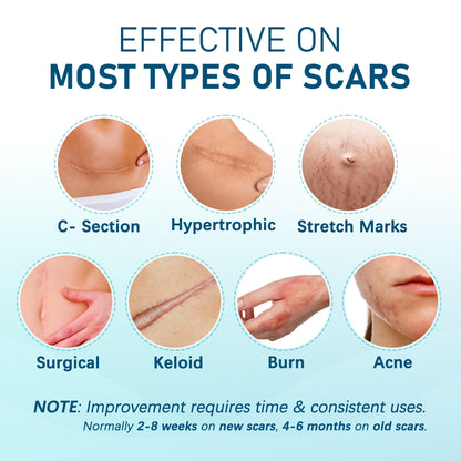 MEDLOT Silicone Scar Sheets – 10pcs Reusable Scar Treatment Strips for Surgical, C-Section, Acne Scars | Breathable & Cut-to-Size
