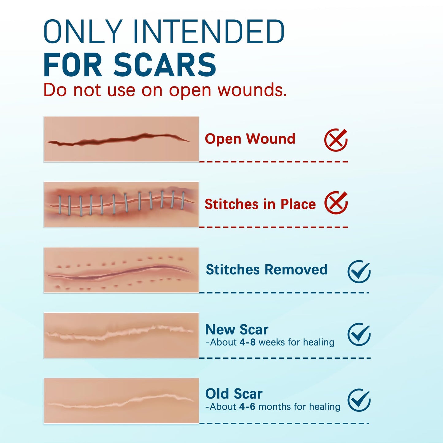 MEDLOT Silicone Scar Sheets – 10pcs Reusable Scar Treatment Strips for Surgical, C-Section, Acne Scars | Breathable & Cut-to-Size
