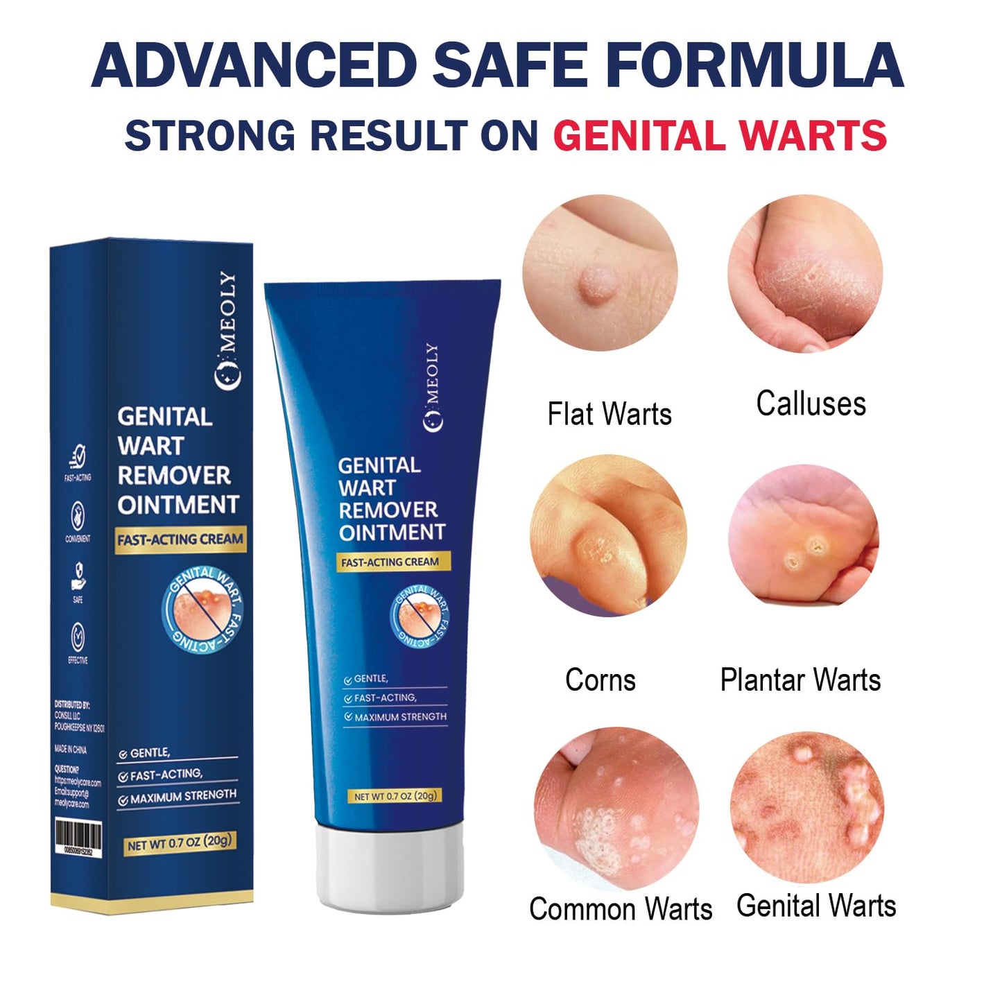 MEOLY Genital Wart Remover Cream: Fast-Acting Salicylic Acid Ointment
