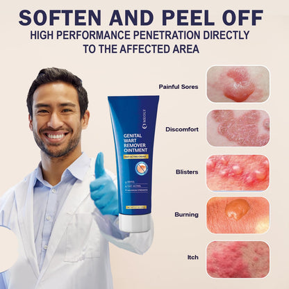 MEOLY Genital Wart Remover Cream: Fast-Acting Salicylic Acid Ointment