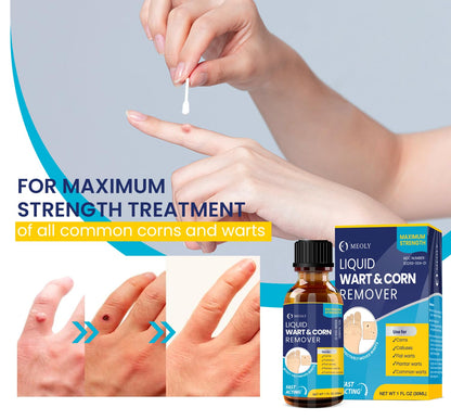 MEOLY Salicylic Wart Removal Freeze Away – Fast-Acting Maximum Strength Wart Remover (30 ml)