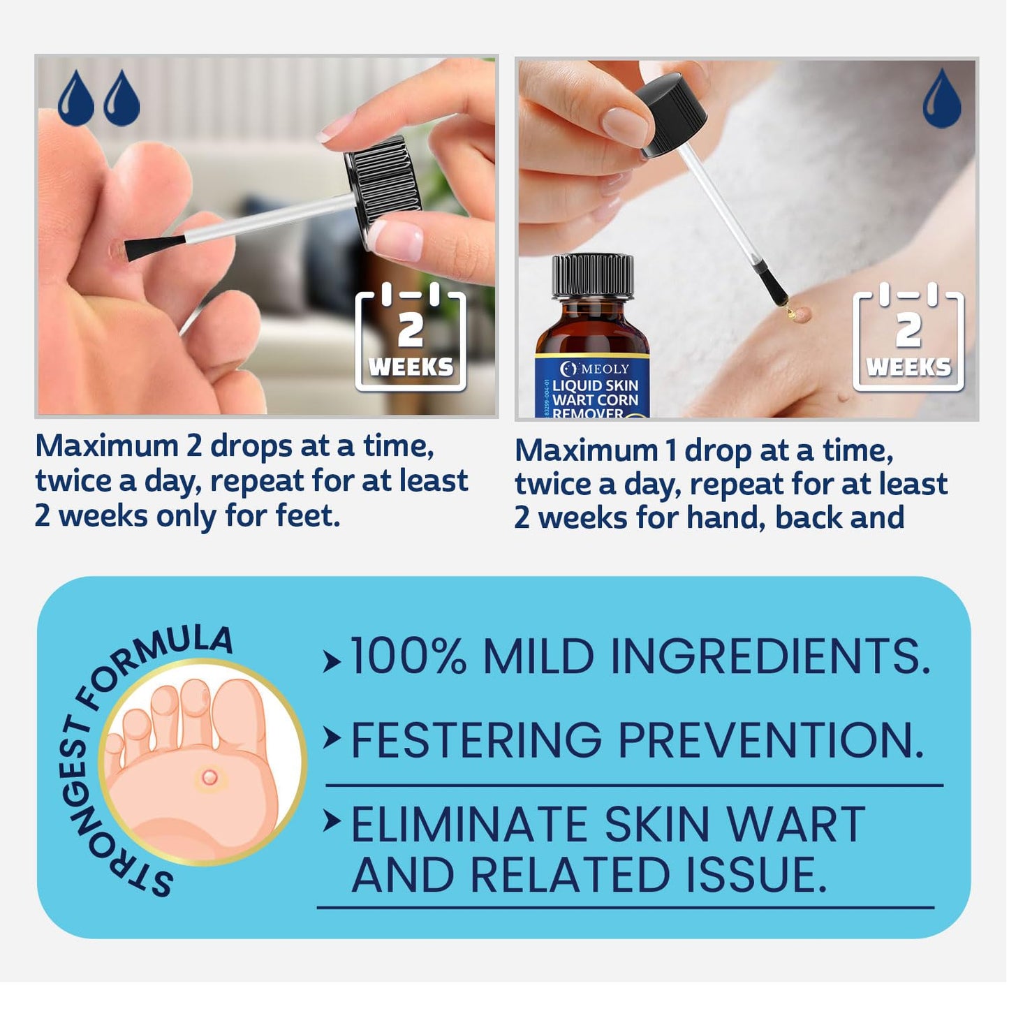 MEOLY Fast-Acting Wart Remover – 40% Salicylic Acid for Plantar Warts & Corns