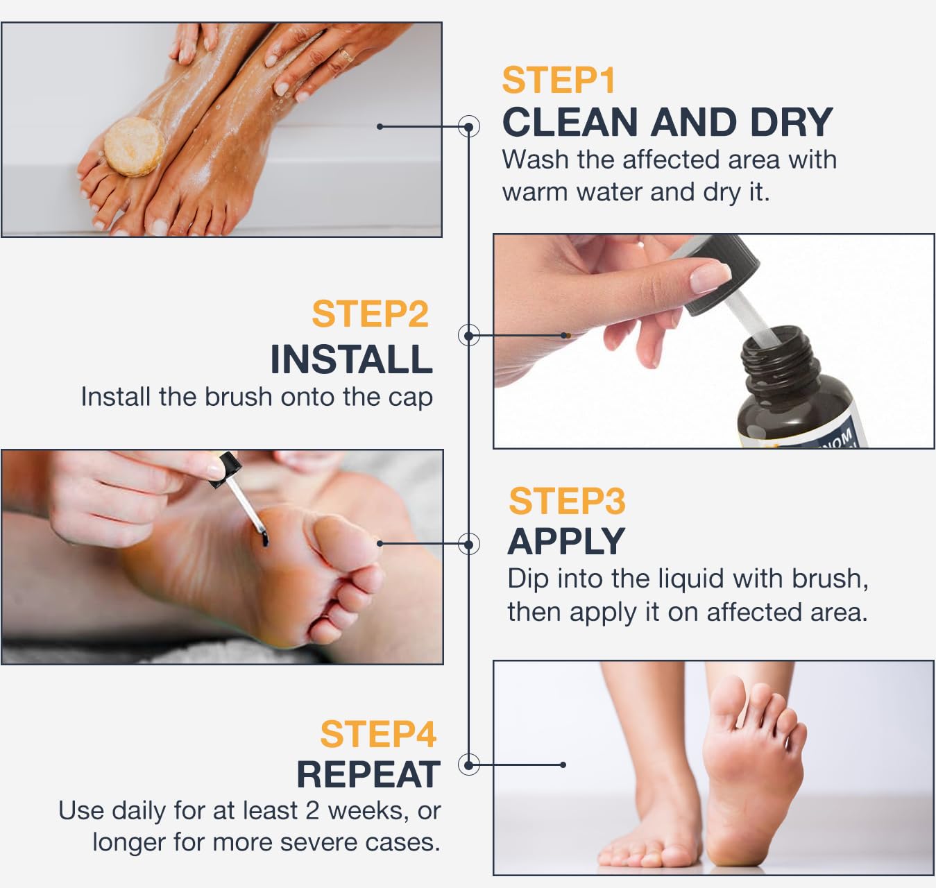 MEOLY Bee Venom Wart Remover – Fast-Acting 20% Salicylic Acid for Plantar and Genital Warts | Targeted Wart Care