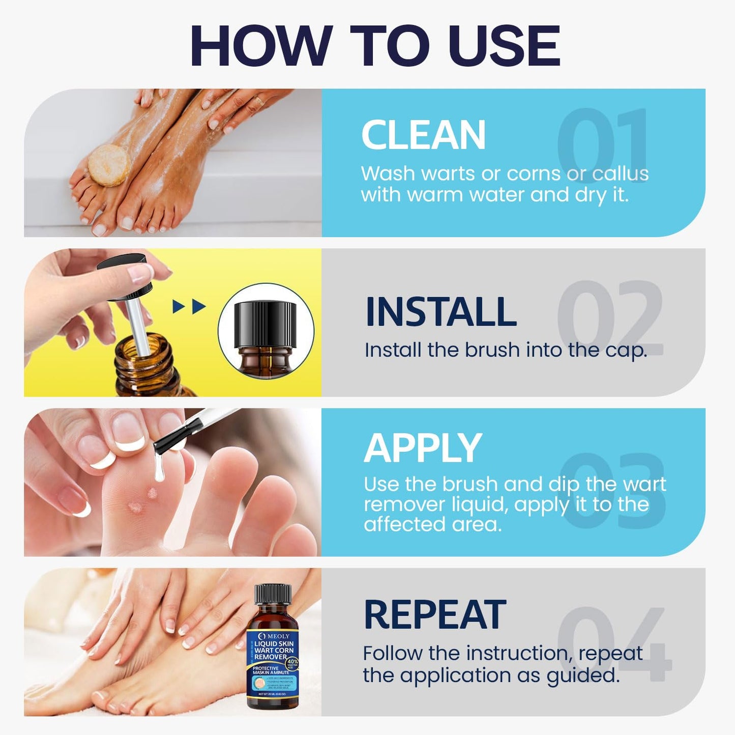 MEOLY Fast-Acting Wart Remover – 40% Salicylic Acid for Plantar Warts & Corns