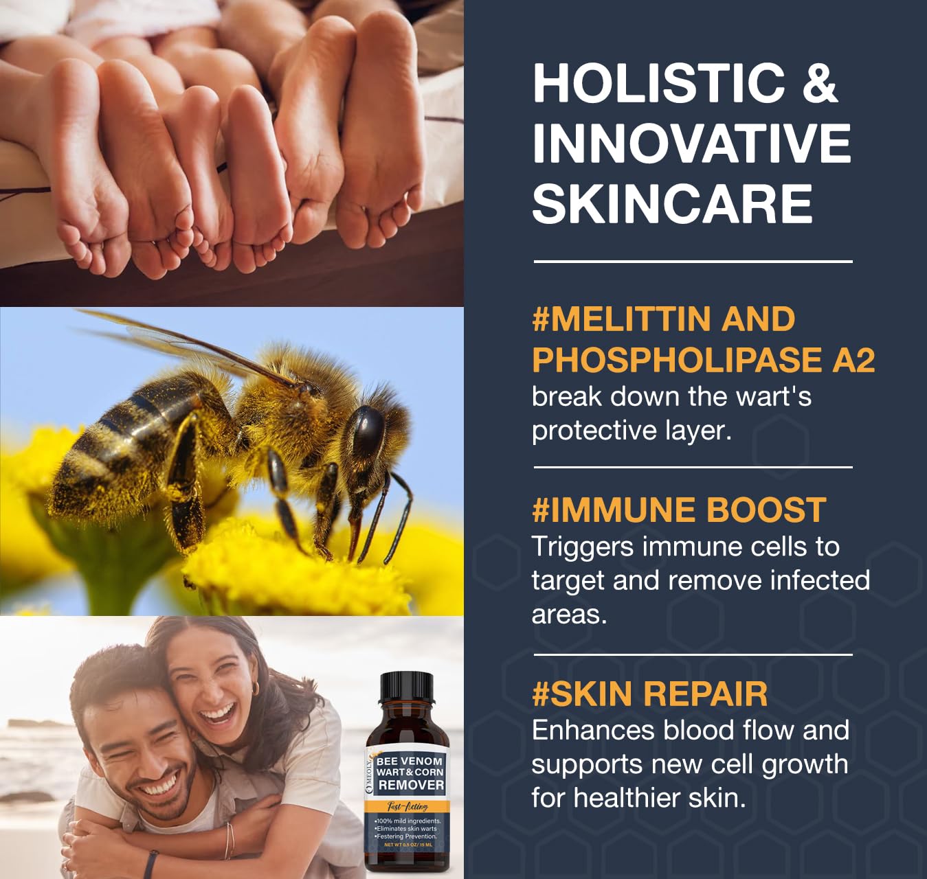 MEOLY Bee Venom Wart Remover – Fast-Acting 20% Salicylic Acid for Plantar and Genital Warts | Targeted Wart Care